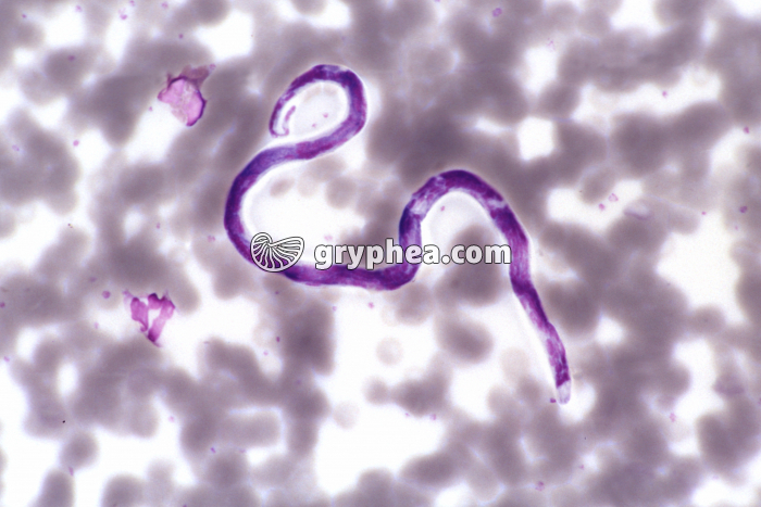 Microfilaire x170 - gryphea.org